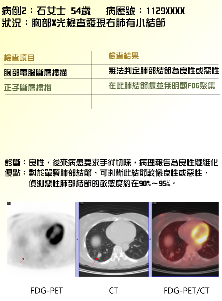 實例2